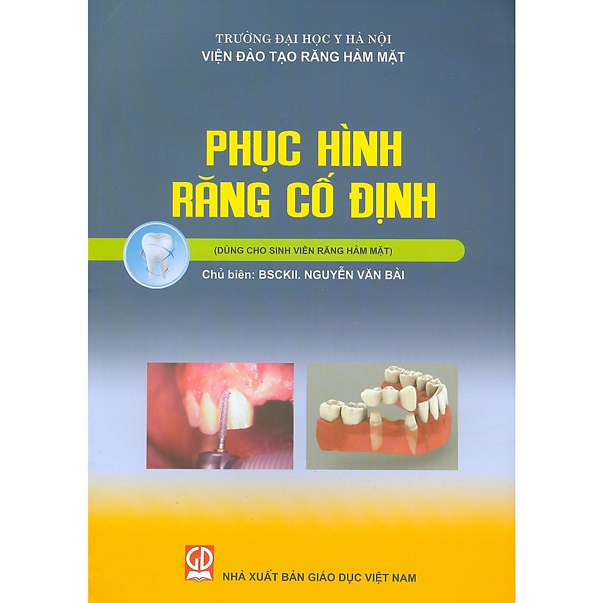 Phục Hình Răng Cố ĐỊnh - Sách dùng cho sinh viên Răng Hàm Mặt 