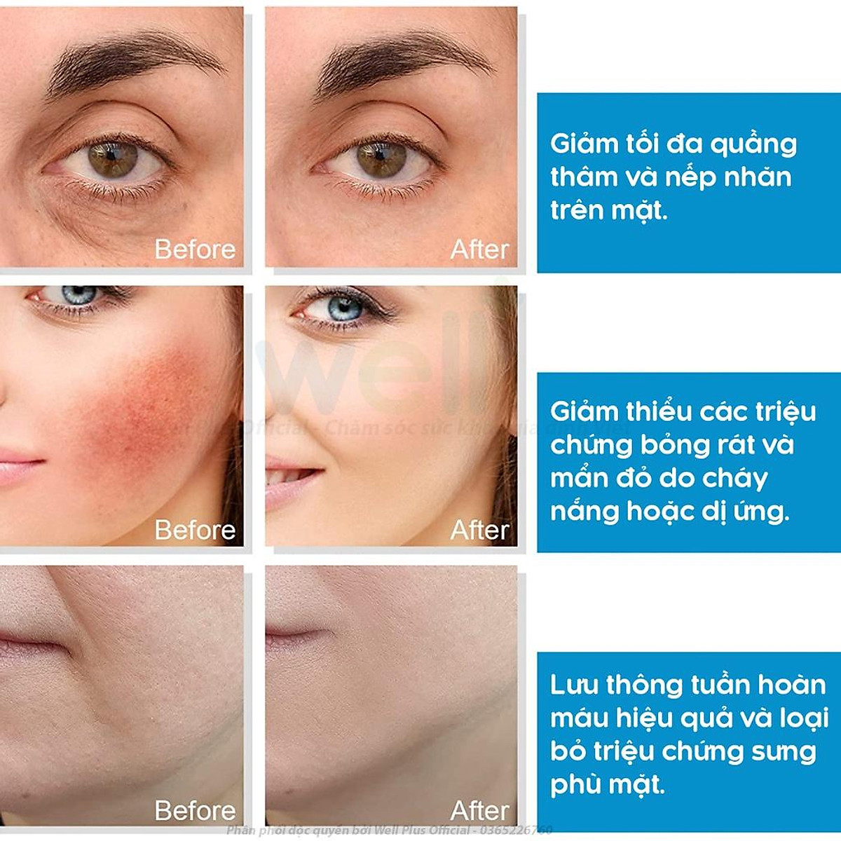 Thanh Lăn Đá Lạnh Massage Mặt Giảm Bọng Mắt Và Thu Nhỏ Lỗ Chân ...