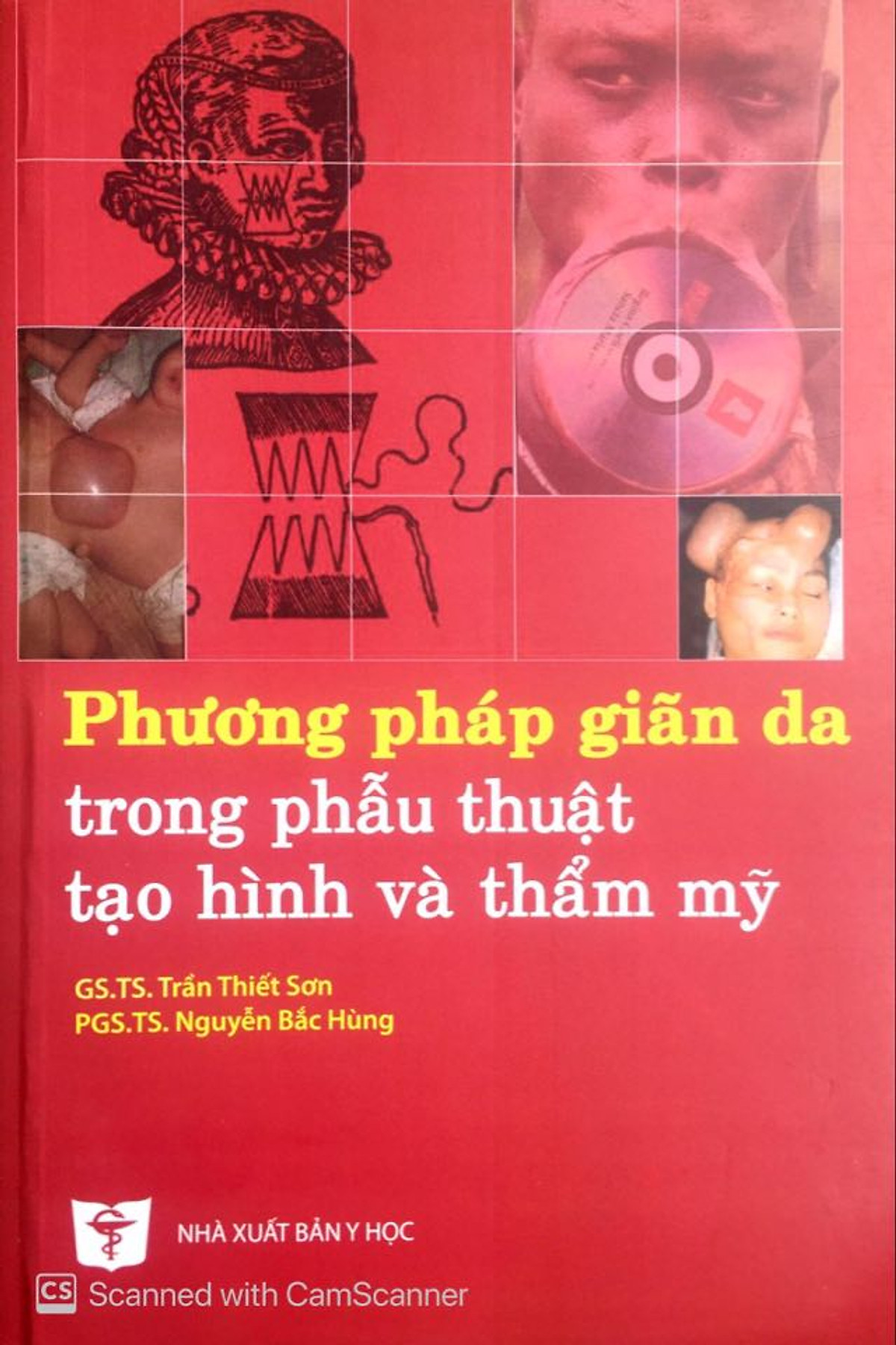 Phương pháp giãn da trong phẫu thuật tạo hình và thẩm mỹ & Ghép da trong phẫu thuật tạo hình thẩm mỹ