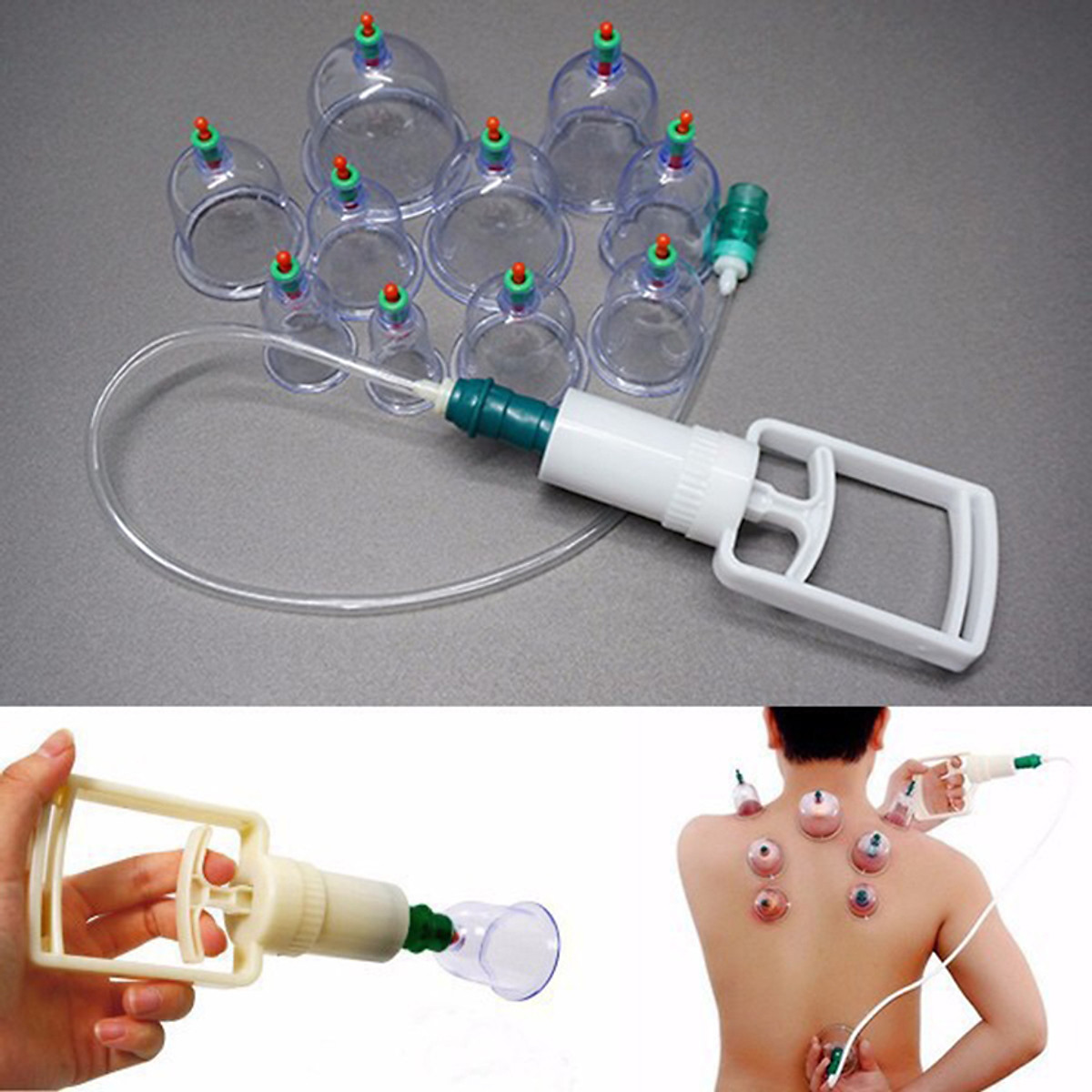Bộ Giác Hơi Hút Chân Không 10 Cốc Không Dùng Lửa Nhỏ Gọn Tiện Lợi ...