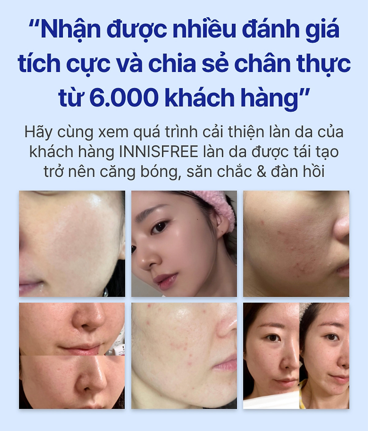 Serum Retinol PDRN tế bào gốc trà xanh cho da căng bóng đàn hồi 25ml