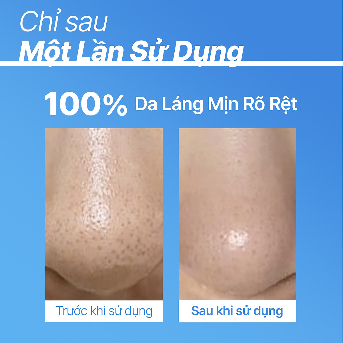 Serum Kiểm Soát Dầu Mụn Cho Da Láng Mịn INNISFREE Retinol Cica Repair Ampoule 30mL