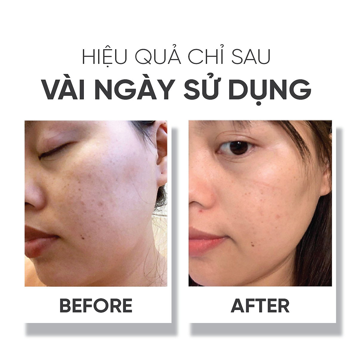 Tinh chất dưỡng trắng da Lá House Astalock Concentrated Essence 15ml/30ml