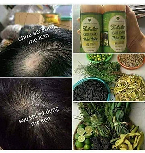 TINH CHẤT GỘI ĐẦU THẢO MỘC MẸ KEN-Chai 250ml