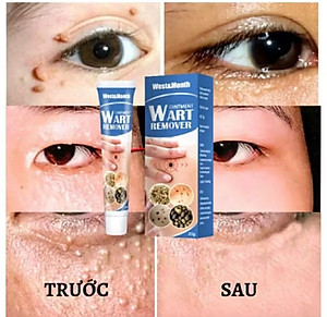 HỘP KEM BÔI TRỊ HẾT MỤN CÓC NÚT RUỒI DA ĐEN SẠM THUẬN TIỆN CHO MỌI NGƯỜI