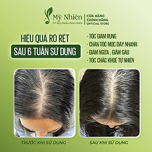 Dầu Gội Thảo Dược MỸ NHIÊN 400ml/Dầu Xả 300ml Dưỡng Tóc Tinh Chất Bồ Kết Hương Thảo - Làm Sạch Da Đầu, Nuôi Dưỡng Tóc Mềm Mượt, Giúp Tóc Khỏe Tự Nhiên