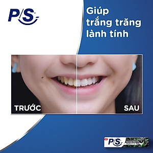 Combo 2 Kem đánh răng P/S Trắng răng than hoạt tính & tre 230g