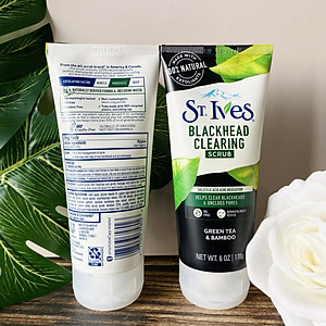 Sữa Rửa Mặt Sạch Mụn Đầu Đen St.Ives Trà Xanh (170g)