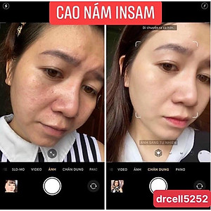 Cao Nám Insam DR CELL 20g hỗ trợ mờ thâm nám dưỡng trắng da la,2 đều màu da - Hàng Chính Hãng