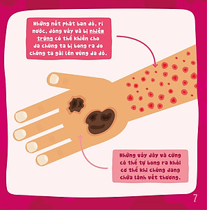 Sách Có Thể Bạn Chưa Biết- Vì Sao Chúng Ta... Bị Bong Da?