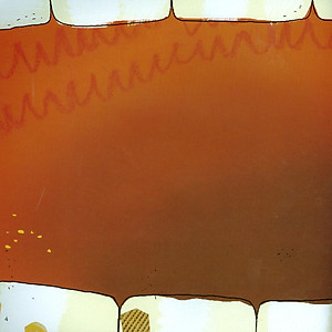 Thắc Mắc Về Vi Khuẩn: Ai Là Thủ Phạm Gây Sâu Răng? (Tái Bản 2019)