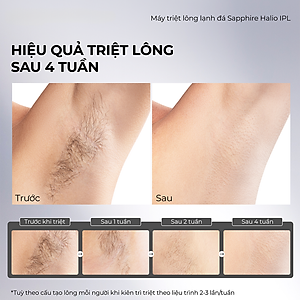 Máy Triệt Lông Lạnh Sapphire Halio InfinityGlow Advanced IPL Sapphire Cooling Hair Removal Device