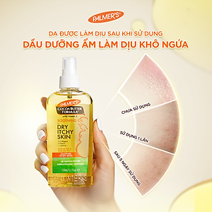 Dầu giảm nhanh khô ngứa da khi mang thai Palmer's 150ml
