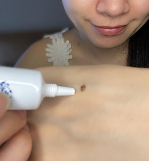 GEL HỖ TRỢ XOÁ MỤN THỊT CỔ BAN ĐÊM TSUBUPORON NIGHT PACK - XÓA MỤN THỊT VÙNG CỔ NHẬT BẢN