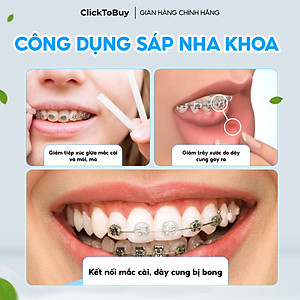 Sáp Nha Khoa Coral 10 mùi , Sáp Giảm Đau Khi Chỉnh Nha, Niềng Răng, Giảm Nhiệt Miệng