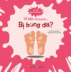 Sách Có Thể Bạn Chưa Biết- Vì Sao Chúng Ta... Bị Bong Da?