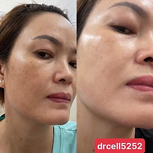 Cao Nám Insam DR CELL 20g hỗ trợ mờ thâm nám dưỡng trắng da la,2 đều màu da - Hàng Chính Hãng