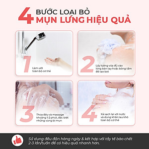 Sữa Tắm Giảm Mụn Lưng Oriss Giúp Giảm Thâm Mụn, Viêm Nang Lông Chai 300ml