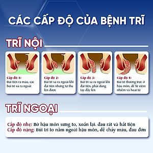 Viên Uống Hỗ Trợ Co Thắt Búi Trĩ Trimax Hủ 30 Viên Nguyên Liệu Từ Thiên Nhiên