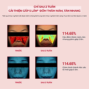 Siêu Tinh Chất Giảm Thâm Nám Chuyên Biệt Angel's Liquid Tranexamic Mela Zero Ampoule 30ml