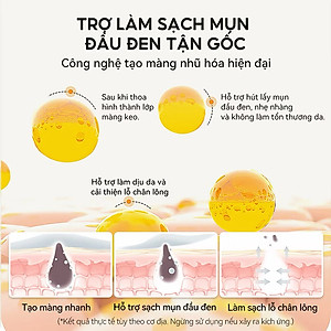 Gel Lột Mụn Nha Đam OKESHOP 30ml - Giải Pháp Loại Bỏ Mụn Đầu Đen - Mụn Cám - Bạ Nhờn - Làm Sạch Sâu Và Thu Nhỏ Lỗ Chân Lông