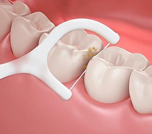 Hộp 50 Tăm Chỉ Nha Khoa Tăm Nhựa Nha Khoa Tiện Dụng Làm Sạch Răng