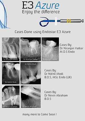 Trâm file nội nha từ châu Âu EndoStar E3 Azure-file dẻo