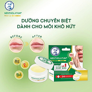Son dưỡng môi dạng sáp chuyên biệt dành cho môi khô, nứt nẻ Mentholatum Medi Lip Balm 7g
