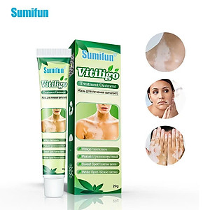 [Vilitigo] Chiết xuất thảo dược, Kem bôi lang ben, hắc lào, nấm ngứa, á sừng, vẩy nến loại tốt an toàn hiệu quả