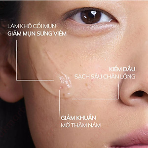 Gel Mụn Khẩn Cấp SOS Compliment No Problem 25ml