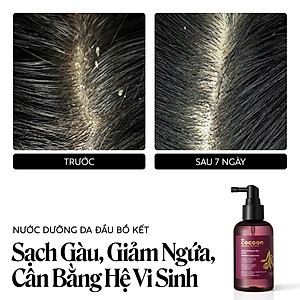 Nước dưỡng da đầu bồ kết Cocoon giảm gàu và chăm sóc da đầu nhạy cảm 140ml