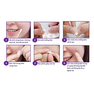 Combo 5 Miếng Dán hỗ trợ điều trị Mụn Mayancare 20 Miếng (0.8cm)