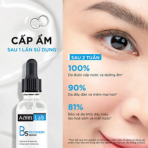 Serum dưỡng ẩm chuyên sâu, làm dịu da Acnes Lab B5 Recovery Serum 25ml