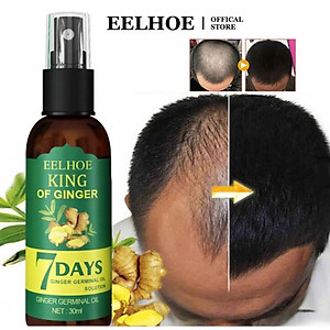 Tinh Dầu Xịt Mọc Tóc EELHOE: Tinh Chất Nhân Sâm và Gừng Tươi Thiên Nhiên Kích Thích Mọc Tóc Sau 7 Ngày Loại Tốt