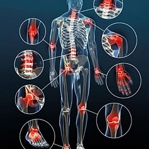 (HSD 06/2026) Viên Uống Glucosamine Chondroitin With Msm Giúp Giảm Đau Do Viêm Xương Khớp Hộp 100 Viên