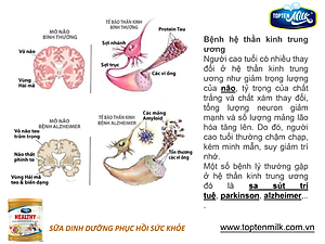 Sữa bột tăng cân,hổ trợ tiêu hóa healthy 400g TOPTEN Milk