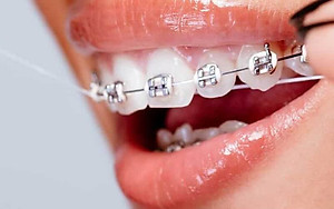 Cuộn chỉ nha khoa Lion Clinica Advantage 40m làm sạch các mảng bám giữa kẽ răng & ngăn ngừa các bệnh lý về răng miệng - Made in Japan