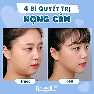 Đai It's Well Plus 4D Định Hình Khuôn Mặt Chữ V - Loại 1 (V-line)
