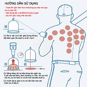 Bộ 6 ly giác hơi không dùng lửa Duy Thành YGH05 được bộ y tế cấp phép lưu hành an toàn cho sức khỏe | Thương hiệu hàng Việt Nam chất lượng cao 2019 | Fireless cupping therapy YGH05