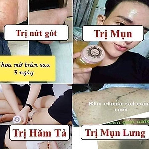 Mỡ Trăn N'store Nguyên Chất Triệt Lông Vĩnh Viễn, Giảm Bỏng Da, Dưỡng Da, Ngăn Ngừa Rạn Nứt Da (1 Chai 100ML)