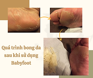 MẶT NẠ Ủ CHÂN BABY FOOT CHO DA GÓT CHÂN KHÔ VÀ NỨT NẺ NHẬT BẢN