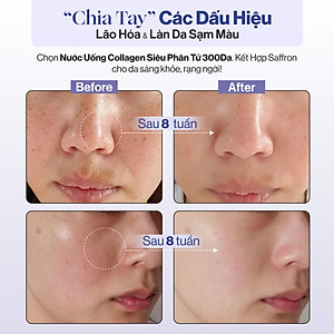 NƯỚC UỐNG COLLAGEN GILAA SIÊU PHÂN TỬ 300DA KẾT HỢP SAFFRON TRẺ HÓA TRẮNG KHỎE DA (20g x 15 gói)
