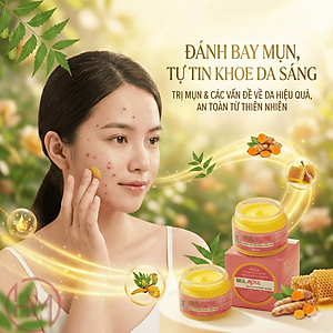 Kem nghệ đa năng Mulrose 30g Dưỡng da, giảm mụn, mờ thâm, se khít lỗ chân lông, chàm sữa, hăm, bị bỏng, vết thương hở.. Mul Rose [Chính Hãng]