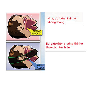 Đai nẹp cằm chống ngáy khi ngủ Stop Snoring belt Aolikes YE-2107