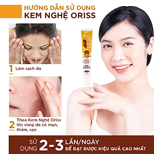 Kem Nghệ Giảm Mụn Oriss Giúp Mờ Thâm Sẹo Dưỡng Ẩm Sáng Da 20g