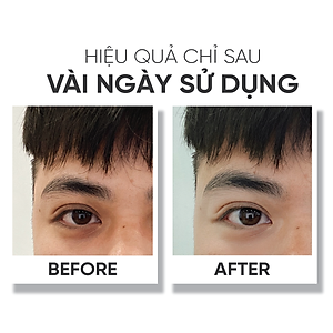 Kem dưỡng vùng da quanh mắt Lá House Recovery Eye Cream 15ml