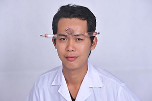 Bộ Giác Hơi Không Dùng Lửa Duy Thành YGH01