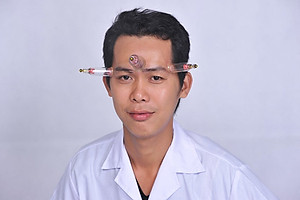 Bộ Giác Hơi Không Dùng Lửa Duy Thành YGH02