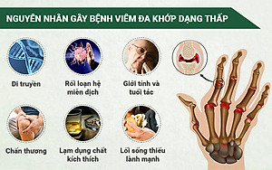 PQA Xuyên Khung Xương Khớp là dược phẩm thảo dược cho người bị viêm khớp dạng thấp, đau nhức xương khớp, cử động khó khăn, các khớp sưng đau hỗ trợ hạn chế đau nhức, giảm các triệu chứng của viêm khớp