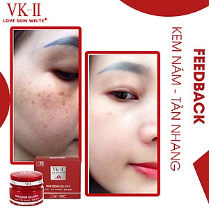 Kem Ngừa Nám - Tàn Nhang - Đồi Mồi VK II ( 10g/20g )